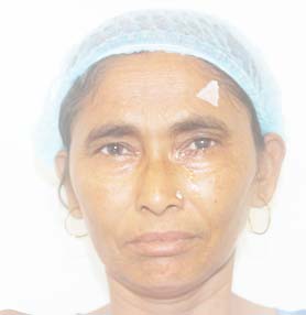 patient Image